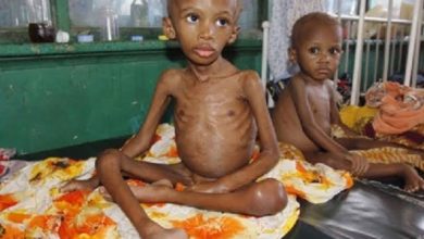 Does Nigeria have highest number of malnourished children in Africa?