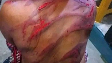False! Woman in viral picture beaten by male assailants, not daughter-in-law