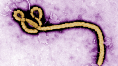 Aarun Ebola: oun ti o ni lati mọ̀, àpeere aisan ati bi o ṣe le daabo bo ara rẹ