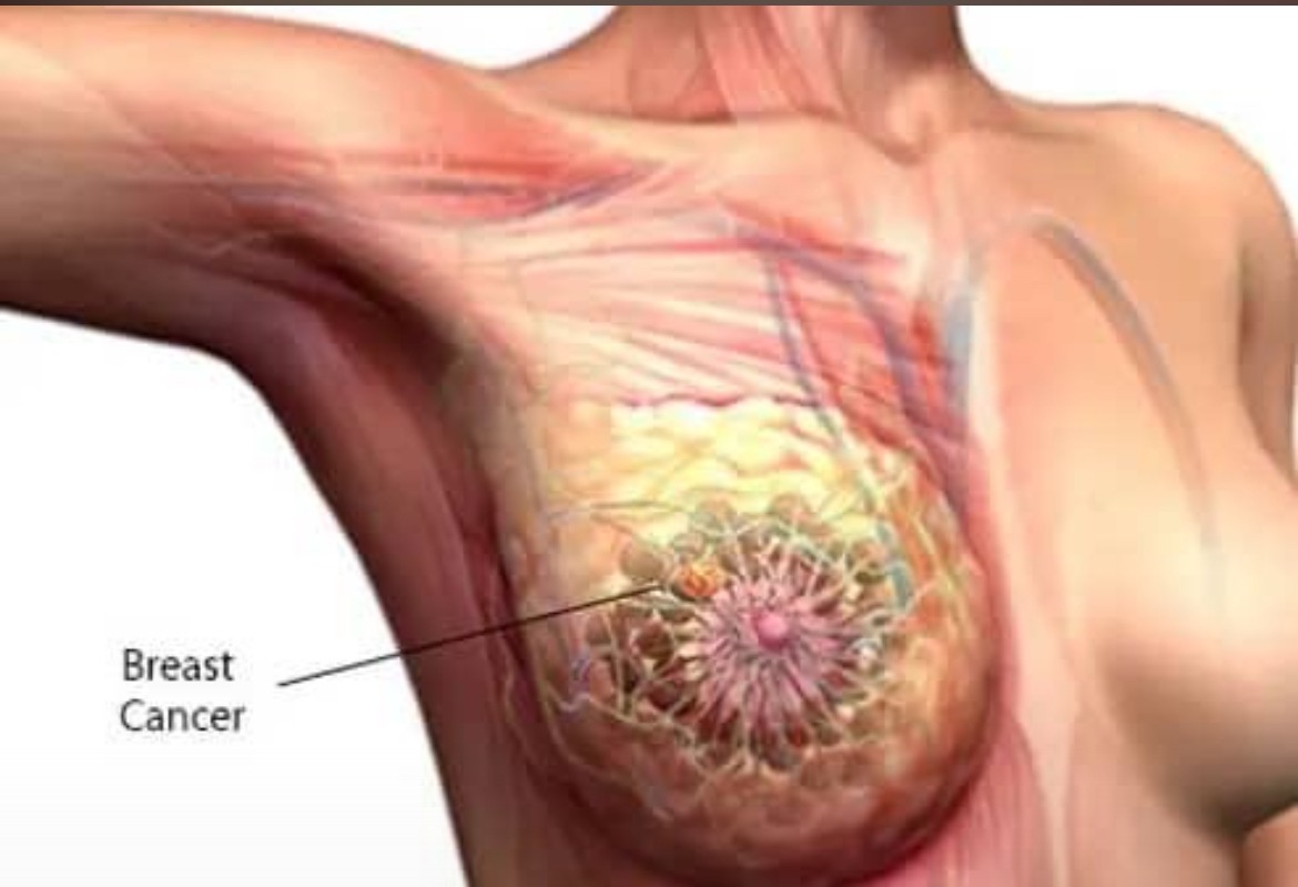 2022 ACF Free cancer treatment, recirculated in 2026